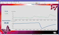 Stress Control Suite