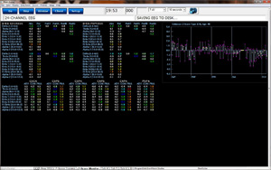 qEEGPro 4Ch ZScore Training
