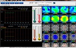 qEEGPro Surface ZScore Training